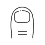 Benőtt köröm kezelése